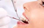 Лечение десен в стоматологии