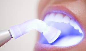 Можно ли пить воду после пломбирования зуба