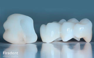 Цирконий в стоматологии