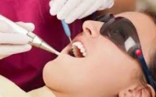 Противопоказания при имплантации зубов