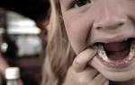Какие пломбы ставят на молочные зубы