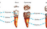 Удаление корешков зуба